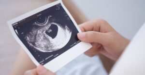 Floridians Challenge Abortion Amendment After Reports of Fraud