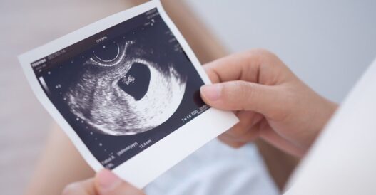 Floridians Challenge Abortion Amendment After Reports of Fraud