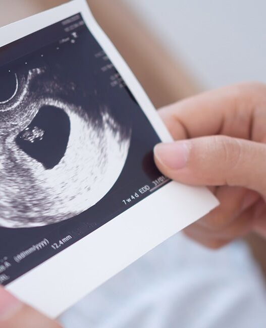 Floridians Challenge Abortion Amendment After Reports of Fraud