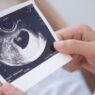 Floridians Challenge Abortion Amendment After Reports of Fraud